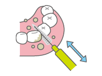 歯間ブラシ